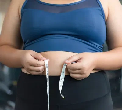 Obesity