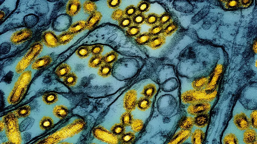 H5N1