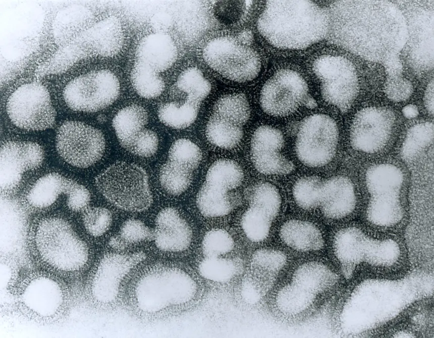 Avian Flu