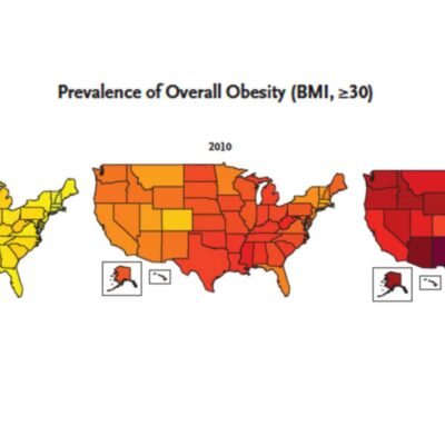 Obesity Epidemic in the USA