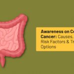 Colon Cancer