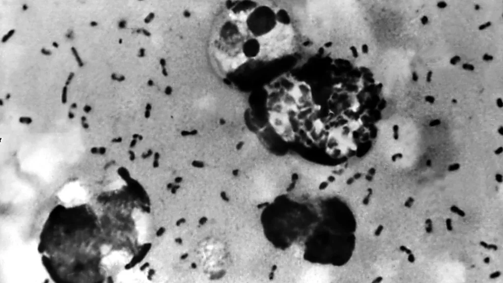 Arizona plague death