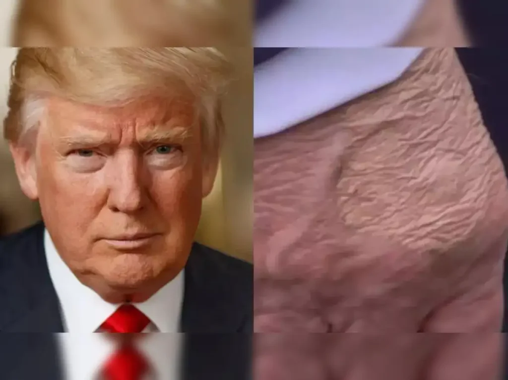 Trump health rumor