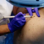 Legionnaires' disease in New York City