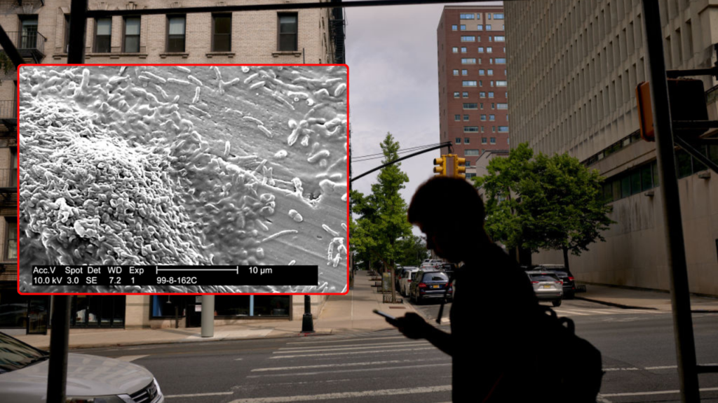 Legionnaires' disease in New York City