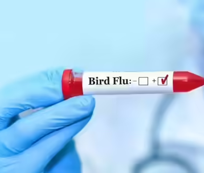 Bird Flu